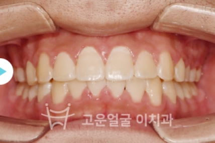 치료후기 이미지